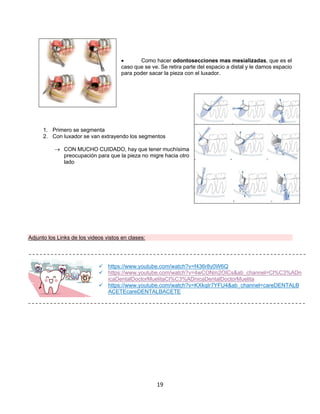 19
• Como hacer odontosecciones mas mesializadas, que es el
caso que se ve. Se retira parte del espacio a distal y le damos espacio
para poder sacar la pieza con el luxador.
1. Primero se segmenta
2. Con luxador se van extrayendo los segmentos
® CON MUCHO CUIDADO, hay que tener muchísima
preocupación para que la pieza no migre hacia otro
lado
Adjunto los Links de los videos vistos en clases:
ü https://www.youtube.com/watch?v=f436r8y0W6Q
ü https://www.youtube.com/watch?v=4wCONm2OICs&ab_channel=Cl%C3%ADn
icaDentalDoctorMuelitaCl%C3%ADnicaDentalDoctorMuelita
ü https://www.youtube.com/watch?v=KXkqIr7YFU4&ab_channel=careDENTALB
ACETEcareDENTALBACETE
 