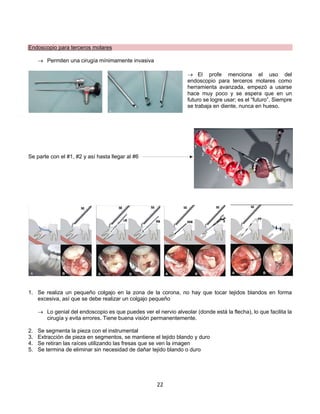 22
Endoscopio para terceros molares
® Permiten una cirugía mínimamente invasiva
® El profe menciona el uso del
endoscopio para terceros molares como
herramienta avanzada, empezó a usarse
hace muy poco y se espera que en un
futuro se logre usar; es el “futuro”. Siempre
se trabaja en diente, nunca en hueso.
Se parte con el #1, #2 y así hasta llegar al #6
1. Se realiza un pequeño colgajo en la zona de la corona, no hay que tocar tejidos blandos en forma
excesiva, así que se debe realizar un colgajo pequeño
® Lo genial del endoscopio es que puedes ver el nervio alveolar (donde está la flecha), lo que facilita la
cirugía y evita errores. Tiene buena visión permanentemente.
2. Se segmenta la pieza con el instrumental
3. Extracción de pieza en segmentos, se mantiene el tejido blando y duro
4. Se retiran las raíces utilizando las fresas que se ven la imagen
5. Se termina de eliminar sin necesidad de dañar tejido blando o duro
 