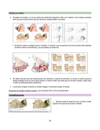 24
Colgajo en maxilar
• Al palpar el maxilar y si no se siente por distal del segundo molar una “malicia” (no se logra entender
bien que dice) quiere decir que los terceros molares están muy altos.
® El Doctor vuelve a señalar que el “escalón” o “terraza” que se genera en la zona donde está retenido
el tercer molar es beneficioso, ya que facilita la exodoncia
• Se debe recordar que las extracciones son siempre y cuando se ameriten, a veces no vale la pena el
riesgo biológico que se corre para extraer un tercer molar que está casi en el seno maxilar, sobre todo
si este no está generando problemas
• La primera imagen muestra un amplio colgajo, innecesario según el doctor
Esquema de colgajo maxilar superior: Uso de bisturí #12 y #15 principalmente
Complicaciones
® Siempre está el riesgo de que un tercer molar
superior se vaya hacia el seno maxilar
 