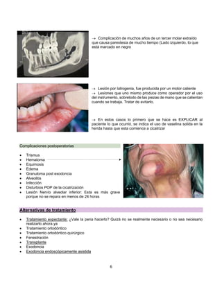 6
® Complicación de muchos años de un tercer molar extraído
que causa parestesia de mucho tiempo (Lado izquierdo, lo que
está marcado en negro
® Lesión por Iatrogenia, fue producida por un motor caliente
® Lesiones que uno mismo produce como operador por el uso
del instrumento, sobretodo de las piezas de mano que se calientan
cuando se trabaja. Tratar de evitarlo.
® En estos casos lo primero que se hace es EXPLICAR al
paciente lo que ocurrió, se indica el uso de vaselina solida en la
herida hasta que esta comience a cicatrizar
Complicaciones postoperatorias
• Trismus
• Hematoma
• Equimosis
• Edema
• Granuloma post exodoncia
• Alveolitis
• Infección
• Disturbios POP de la cicatrización
• Lesión Nervio alveolar inferior: Esta es más grave
porque no se repara en menos de 24 horas
Alternativas de tratamiento
• Tratamiento expectante: ¿Vale la pena hacerlo? Quizá no se realmente necesario o no sea necesario
realizarlo ahora ya
• Tratamiento ortodóntico
• Tratamiento ortodóntico quirúrgico
• Fenestración
• Transplante
• Exodoncia
• Exodoncia endoscópicamente asistida
 