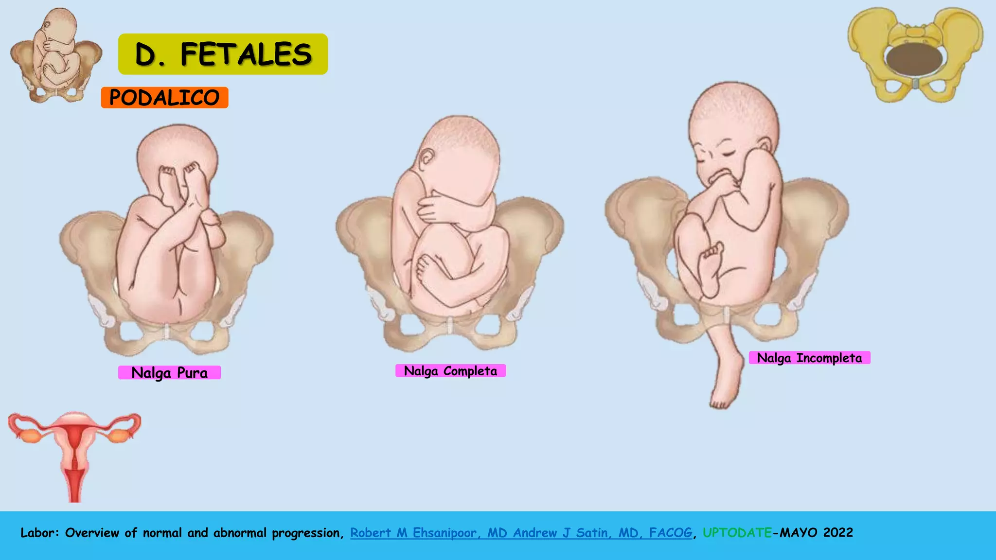 6.Distocias de TdP.pptx