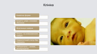Клініка
Анемічна форма
Блідість шкіри, слизових
оболонок
Жовтяниця помірна
Гепато- та спленомегалія
помірні
Неврологічний статус без
порушень
Лабораторно – анемія,
ретикулоцитоз
 