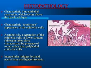 6.desquamative gingivitis.ppt