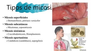 Tipos de micosis
• Micosis superficiales
oDermatofitosis, pitiriasis versicolor
• Micosis subcutáneas
o Micetomas, esporotricosis
• Micosis sistémicas
o Coccidiodomicosis, Histoplasmosis
• Micosis oportunistas
oCandidiosis (candidiasis), aspergilosis
 