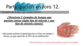 Participación en foro 12.
¿Menciona 2 ejemplos de hongos que
puedan causar algún tipo de micosis y que
tipo de micosis causan?
• Recuerda realizar la participación en foro en tiempo y
forma, ya que equivale al 10% de tu calificación
• Ejemplos de hongos que causan micosis
Nota: Recuerda que no se permite colocar al género Candida, en los ejemplos.
 