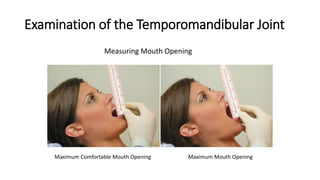 6. TMJ DISORDER.pptx