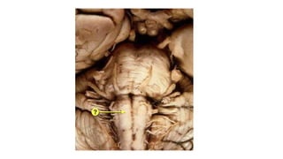 6.4.23 neuroanatomy.pdf