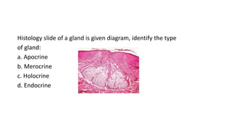 Histology slide of a gland is given diagram, identify the type
of gland:
a. Apocrine
b. Merocrine
c. Holocrine
d. Endocrine
 