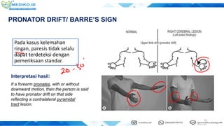 Pronator Rift 6.1 Coretan Slide Neurologi 1 - dr. Febby.pdf