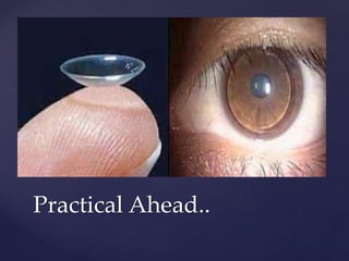 Infant Rgp 6. Pre-fitting Assessment of rgp lens.ppt