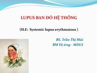 LUPUS BAN ĐỎ HỆ THỐNG
(SLE: Systemic lupus erythmatous )
BS. Trần Thị Mùi
BM Dị ứng - MDLS
 