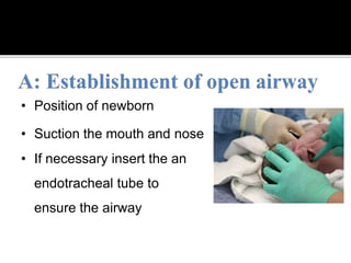 • Position of newborn
• Suction the mouth and nose
• If necessary insert the an
endotracheal tube to
ensure the airway
 