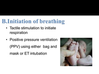 • Tactile stimulation to initiate
respiration
• Positive pressure ventilation
(PPV) using either bag and
mask or ET intubation
 