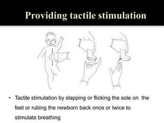 • Tactile stimulation by slapping or flicking the sole on the
feet or rubing the newborn back once or twice to
stimulate breathing
 