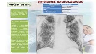 Linfangitis Reticular 6. PATRONES RADIOLOGICOS de imagenología | PPT