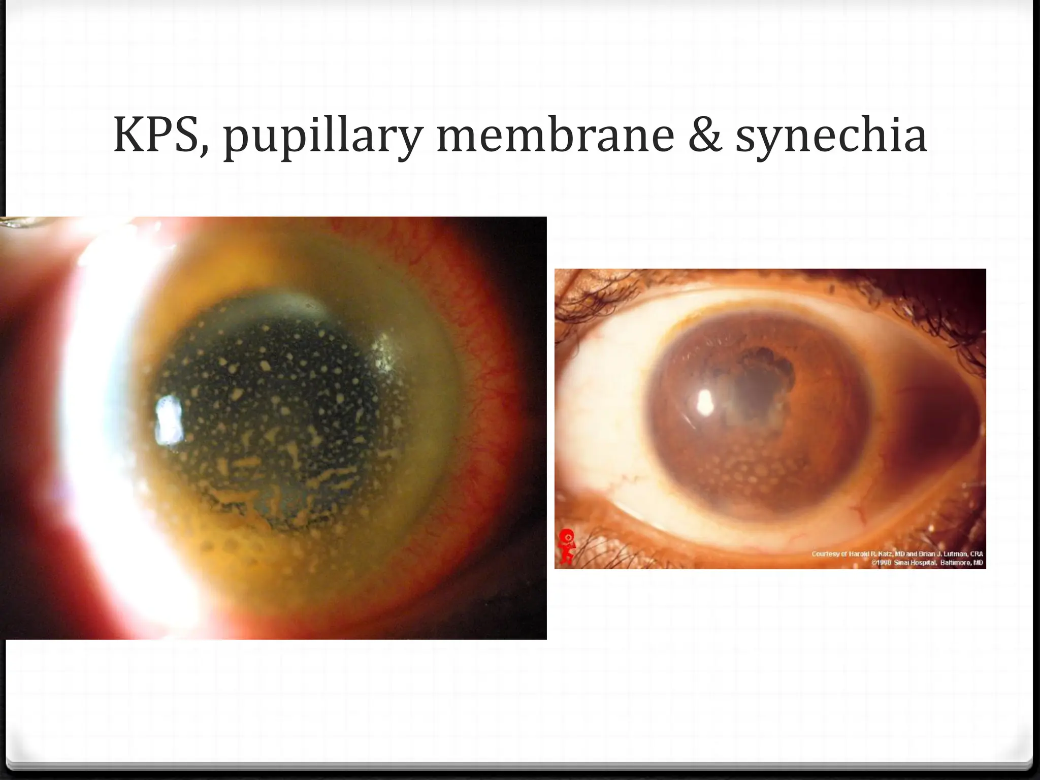 Red eye with Differentials and sample causes | PDF