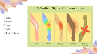ROLE OF COMPLEMENT SYSTEM IN ACUTE INFLAMMATION.pptx