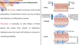 ROLE OF COMPLEMENT SYSTEM IN ACUTE INFLAMMATION.pptx