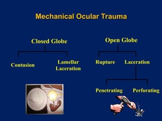 Penetrating Eye Injuries Introduction Types And Management PPT