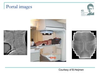 Portal images
EPID
Courtesy of B.Heijmen
 