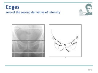 Edges
zero of the second derivative of intensity
11/42
 