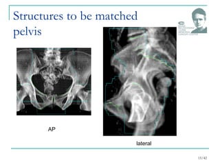 Structures to be matched
pelvis
15/42
AP
lateral
 