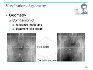Veryfication of geometry
 Geometry
 Comparison of
 reference image and
 treatment field image
Field edges
Center of the beam
4/42
 