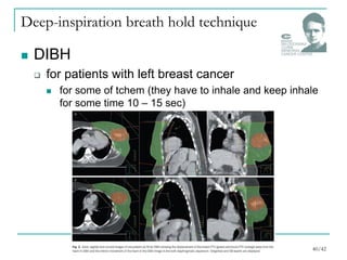 Deep-inspiration breath hold technique
 DIBH
 for patients with left breast cancer
 for some of tchem (they have to inhale and keep inhale
for some time 10 – 15 sec)
40/42
 