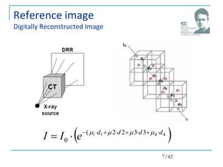 Reference image
Digitally Reconstructed Image
 
4
4
1
1 3
3
2
2
(
0
d
d
d
d
e
I
I 








 



7/42
 