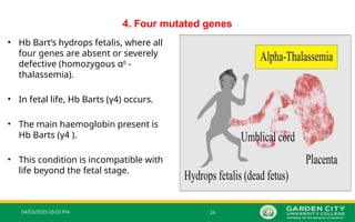 04/03/2025 05:02 PM 26
4. Four mutated genes
• Hb Bart’s hydrops fetalis, where all
four genes are absent or severely
defective (homozygous α0
‐
thalassemia).
• In fetal life, Hb Barts (γ4) occurs.
• The main haemoglobin present is
Hb Barts (γ4 ).
• This condition is incompatible with
life beyond the fetal stage.
 