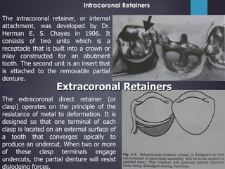 Internal Attachment Rpd 6. Components of RPD.pdf bbvjygcjobccfdgjj | PDF