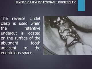 6. Components of RPD.pdf bbvjygcjobccfdgjj | PDF