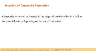 105
Insertion of Composite Restoration
Composite resins can be inserted in the prepared cavities either in a bulk or
incremental pattern depending on the site of restoration.
1. Lahari K, Jaidka S, Somani R et al. Composite Restorations. Int J Adv Res. 2019; 7(10): 761-779.​
 