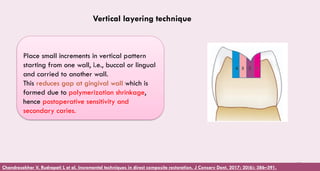 108
Place small increments in vertical pattern
starting from one wall, i.e., buccal or lingual
and carried to another wall.
This reduces gap at gingival wall which is
formed due to polymerization shrinkage,
hence postoperative sensitivity and
secondary caries.
Vertical layering technique
Chandrasekhar V, Rudrapati L et al. Incremental techniques in direct composite restoration. J Conserv Dent. 2017; 20(6): 386–391.
 