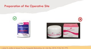 Preparation of the Operative Site
89
1. Lahari K, Jaidka S, Somani R et al. Composite Restorations. Int J Adv Res. 2019; 7(10): 761-779.​
 