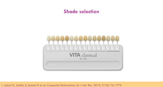 90
Shade selection
1. Lahari K, Jaidka S, Somani R et al. Composite Restorations. Int J Adv Res. 2019; 7(10): 761-779.​
 