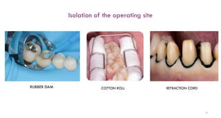 91
Isolation of the operating site
RUBBER DAM COTTON ROLL RETRACTION CORD
 
