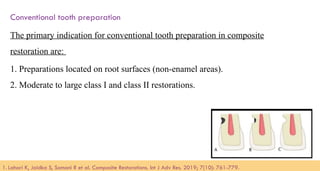 94
Conventional tooth preparation
The primary indication for conventional tooth preparation in composite
restoration are:
1. Preparations located on root surfaces (non-enamel areas).
2. Moderate to large class I and class II restorations.
1. Lahari K, Jaidka S, Somani R et al. Composite Restorations. Int J Adv Res. 2019; 7(10): 761-779.​
 