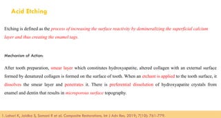 98
Acid Etching
Etching is defined as the process of increasing the surface reactivity by demineralizing the superficial calcium
layer and thus creating the enamel tags.
Mechanism of Action:
After tooth preparation, smear layer which constitutes hydroxyapatite, altered collagen with an external surface
formed by denatured collagen is formed on the surface of tooth. When an etchant is applied to the tooth surface, it
dissolves the smear layer and penetrates it. There is preferential dissolution of hydroxyapatite crystals from
enamel and dentin that results in microporous surface topography.
1. Lahari K, Jaidka S, Somani R et al. Composite Restorations. Int J Adv Res. 2019; 7(10): 761-779.​
 