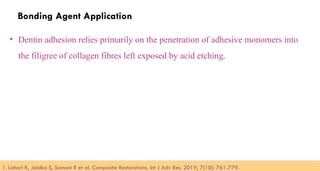 101
Bonding Agent Application
• Dentin adhesion relies primarily on the penetration of adhesive monomers into
the filigree of collagen fibres left exposed by acid etching.
1. Lahari K, Jaidka S, Somani R et al. Composite Restorations. Int J Adv Res. 2019; 7(10): 761-779.​
 