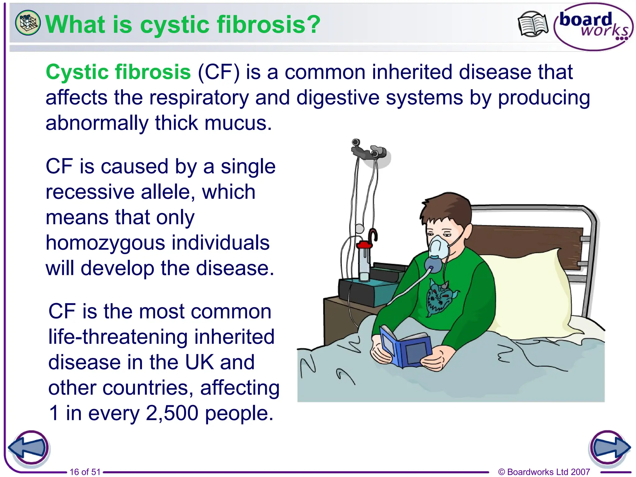 © Boardworks Ltd 2007
16 of 51
What is cystic fibrosis?
Cystic fibrosis (CF) is a common inherited disease that
affects the respiratory and digestive systems by producing
abnormally thick mucus.
CF is caused by a single
recessive allele, which
means that only
homozygous individuals
will develop the disease.
CF is the most common
life-threatening inherited
disease in the UK and
other countries, affecting
1 in every 2,500 people.
 