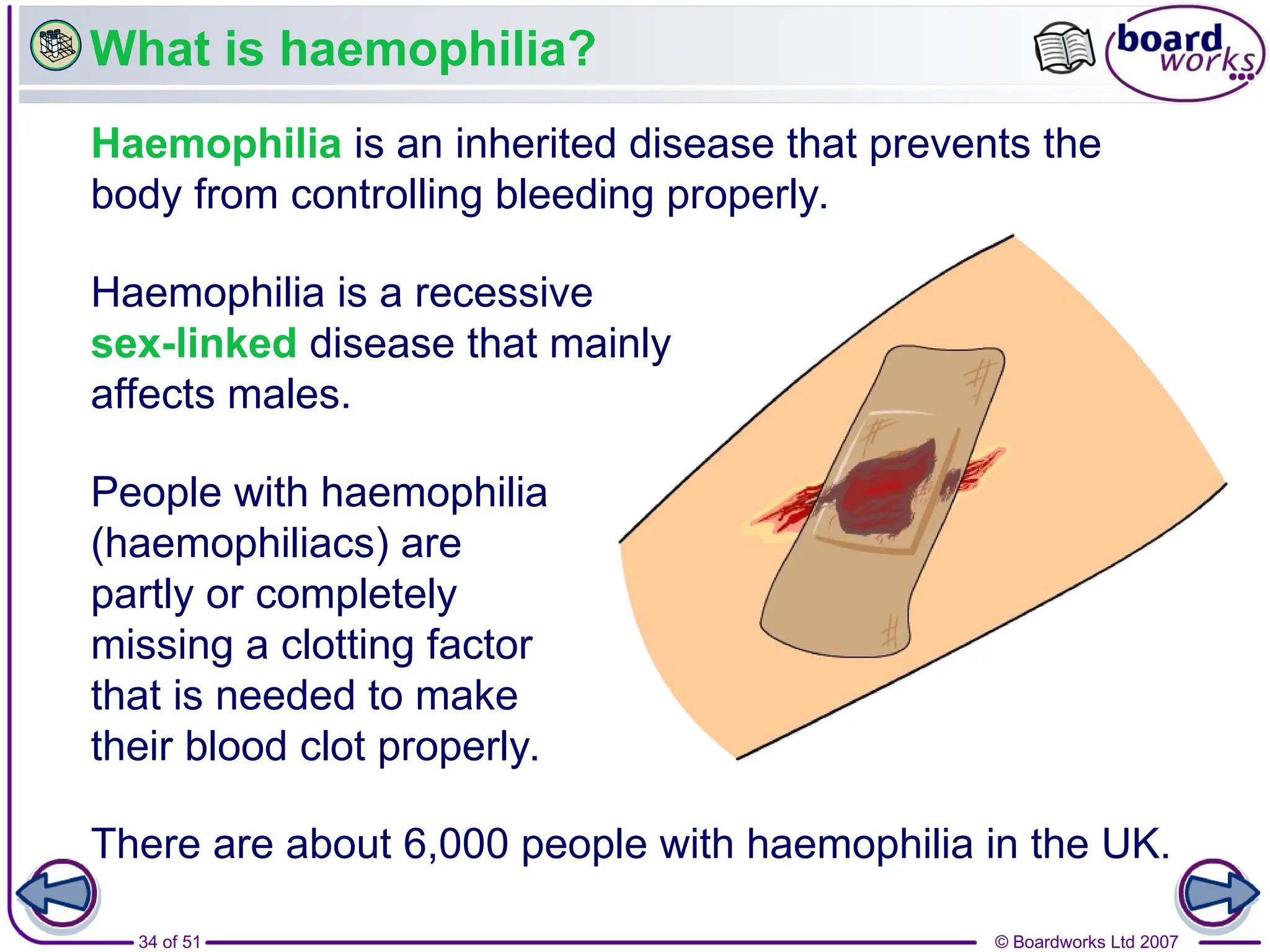 © Boardworks Ltd 2007
34 of 51
What is haemophilia?
Haemophilia is an inherited disease that prevents the
body from controlling bleeding properly.
Haemophilia is a recessive
sex-linked disease that mainly
affects males.
There are about 6,000 people with haemophilia in the UK.
People with haemophilia
(haemophiliacs) are
partly or completely
missing a clotting factor
that is needed to make
their blood clot properly.
 