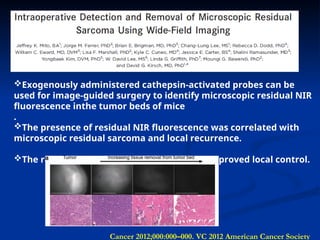Cancer 2012;000:000–000. VC 2012 American Cancer Society
Exogenously administered cathepsin-activated probes can be
used for image-guided surgery to identify microscopic residual NIR
fluorescence inthe tumor beds of mice
.
The presence of residual NIR fluorescence was correlated with
microscopic residual sarcoma and local recurrence.
The removal of residual NIR fluorescence improved local control.
 