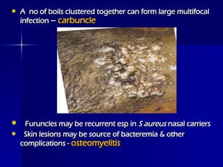 Skin Carbuncle 6.5 SKIN AND SOFT TISSUE INFECTIONS 2017 gm.ppt
