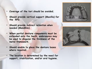 MAJOR CONNECTORS IN REMOVABLE PARTIAL DENTURE | PPTX