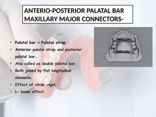MAJOR CONNECTORS IN REMOVABLE PARTIAL DENTURE | PPTX