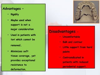 MAJOR CONNECTORS IN REMOVABLE PARTIAL DENTURE | PPTX