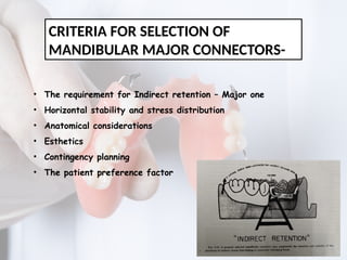 MAJOR CONNECTORS IN REMOVABLE PARTIAL DENTURE | PPTX