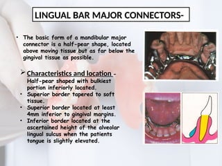MAJOR CONNECTORS IN REMOVABLE PARTIAL DENTURE | PPTX