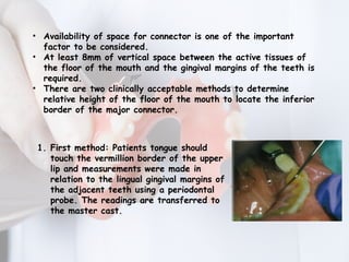 MAJOR CONNECTORS IN REMOVABLE PARTIAL DENTURE | PPTX